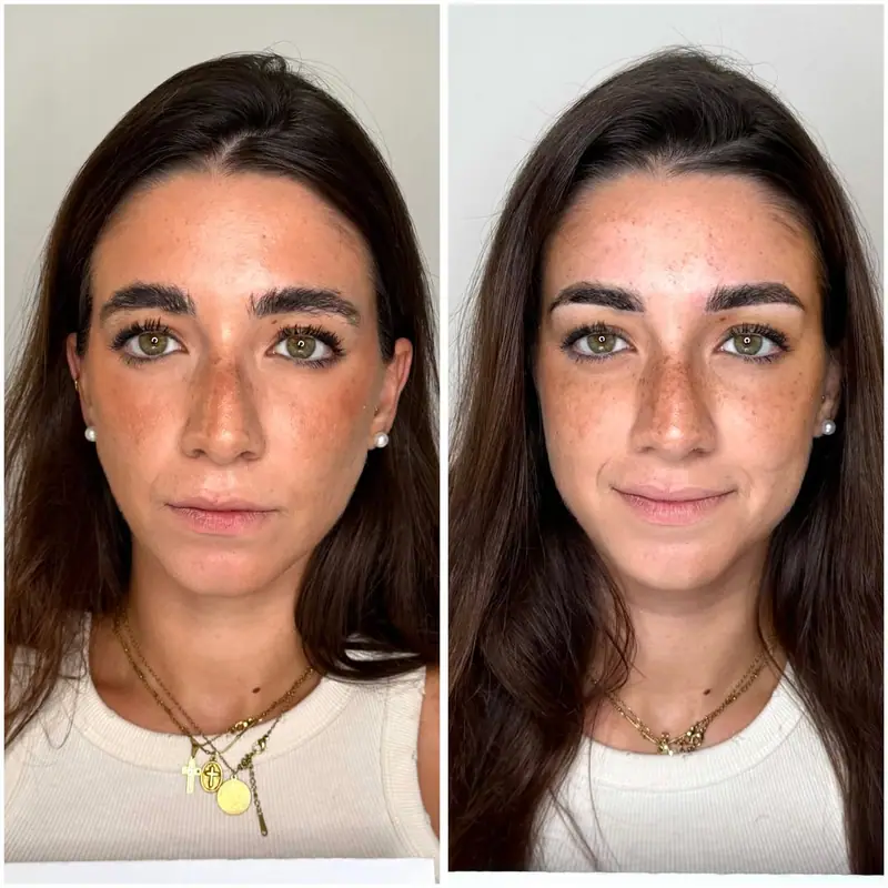 Antes y después del tratamiento
