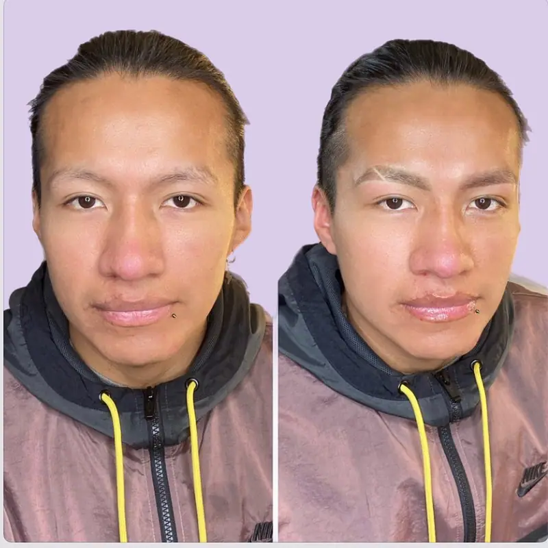 Antes y después del tratamiento