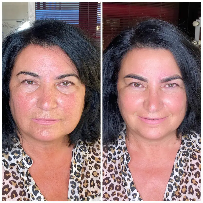 Antes y después