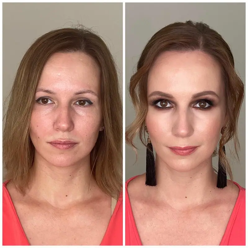 Antes y después del tratamiento