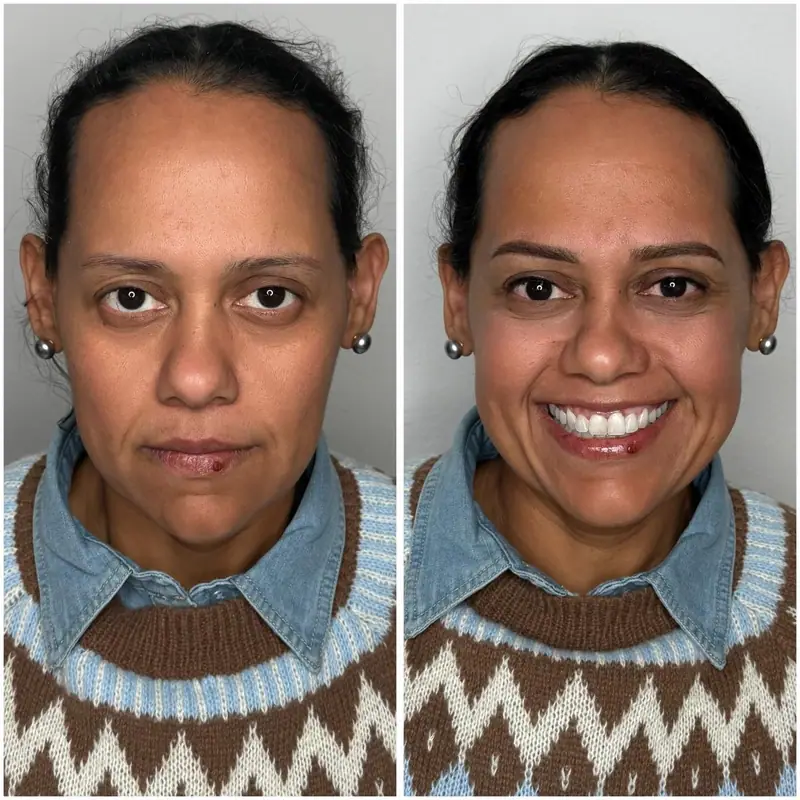 Antes y después