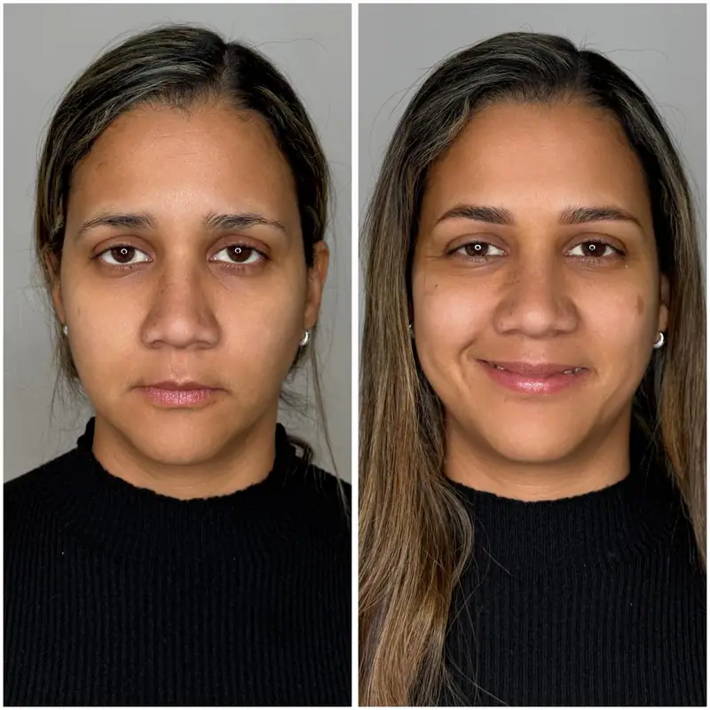 Antes y después