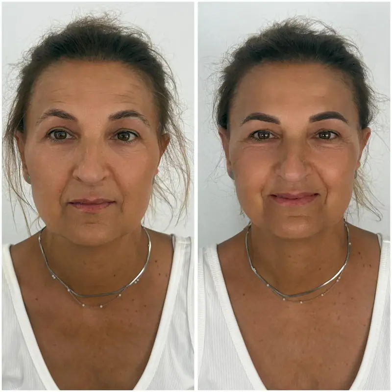 Antes y después del tratamiento