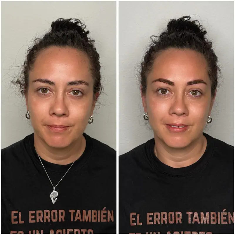 Antes y después